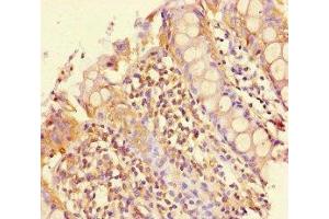 Immunohistochemistry of paraffin-embedded human colon tissue using ABIN7163147 at dilution of 1:100 (PEBP4 antibody  (AA 23-227))