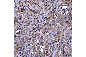 IHC analysis of Septin 11/SEPTIN11 using anti-Septin 11/SEPTIN11 antibody (ABIN7602925). (Septin 11 antibody  (C-Term))