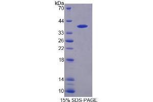 SDS-PAGE analysis of Human PTPN9 Protein. (PTPN9 Protein)