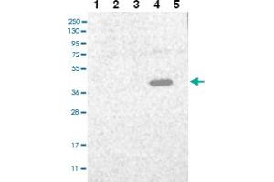 Western blot analysis of Lane 1: RT-4 Lane 2: U-251 MG Lane 3: Human Plasma Lane 4: Liver Lane 5: Tonsil with C3orf33 polyclonal antibody ( Cat # PAB27996 ) at 1:100 - 1:250 dilution. (C3orf33 antibody)