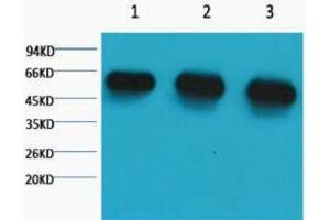 Western Blotting (WB) image for anti-alpha Tubulin (TUBA1) antibody (ABIN3178588) (alpha Tubulin antibody)