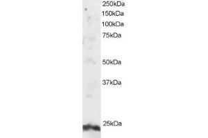 ABIN184801 staining (2µg/ml) of Human Testis lysate (RIPA buffer, 30µg total protein per lane). (ARL4A antibody  (N-Term))