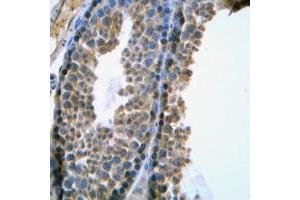 Immunohistochemical analysis of SRY staining in human testis formalin fixed paraffin embedded tissue section. (SRY antibody  (Center))