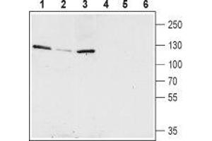 Western blot analysis of rat hippocampus (lanes 1 and 4), mouse brain (lanes 2 and 5) and rat brain (lanes 3 and 6) lysates: - 1-3. (KCNQ5 antibody  (C-Term, Intracellular))