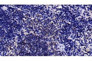 Immunohistochemistry (IHC) image for anti-Interferon alpha (IFNA) (AA 28-227) antibody (ABIN7437731)
