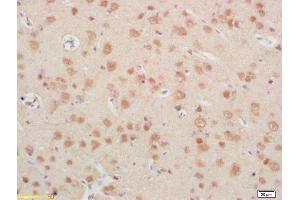 Formalin-fixed and paraffin embedded rat brain labeled with Rabbit Anti IGFBP6 Polyclonal Antibody, Unconjugated (ABIN753298) at 1:200 followed by conjugation to the secondary antibody and DAB staining (IGFBP6 antibody  (AA 141-240))