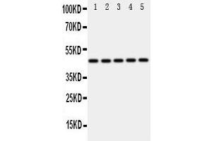Western Blotting (WB) image for anti-Interferon Regulatory Factor 3 (IRF3) (AA 409-427), (C-Term) antibody (ABIN3043039) (IRF3 antibody  (C-Term))