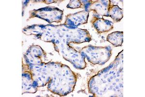 Anti- TFRC antibody,IHC(P) IHC(P): Human Placenta Tissue (Transferrin Receptor antibody  (AA 1-198))