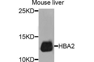 Western blot analysis of extracts of mouse liver cells, using HBA2 antibody. (HBa2 antibody)