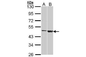 WB Image Sample (30 ug of whole cell lysate) A: H1299 B: Raji 10% SDS PAGE antibody diluted at 1:1000