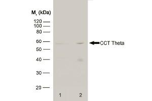 Western blot analysis of HeLa whole cell lysate (1) and HeLa heat stressed whole cell lysate (2) probed with RAT ANTI CCT THETA (ABIN119785) followed by F(ab')2 RABBIT ANTI RAT IgG:HRP (ABIN121399). (CCT8 antibody)