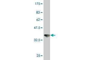 Western Blot detection against Immunogen (36. (VPS11 antibody  (AA 842-941))