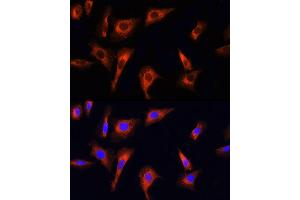 anti-PTEN Induced Putative Kinase 1 (PINK1) (AA 282-581) antibody