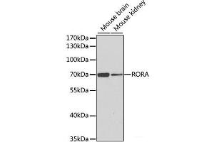 Western blot analysis of extracts of various cell lines using RORA Polyclonal Antibody at dilution of 1:1000. (RORA antibody)