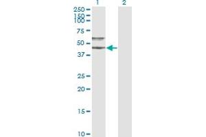 SERPINA3 antibody  (AA 25-423)