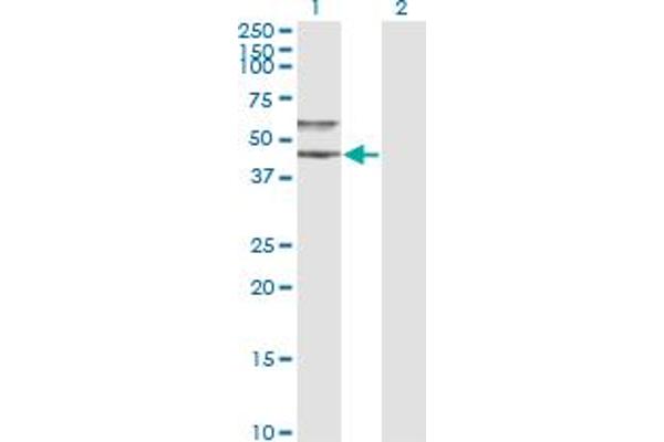 SERPINA3 anticorps  (AA 25-423)
