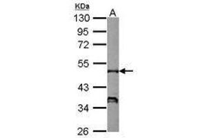 Image no. 1 for anti-Neutrophil Cytosol Factor 1 (NCF1) (AA 1-228) antibody (ABIN1501901) (NCF1 antibody  (AA 1-228))