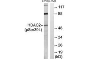 Western Blotting (WB) image for anti-Histone Deacetylase 2 (HDAC2) (pSer394) antibody (ABIN2888429) (HDAC2 antibody  (pSer394))