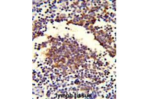 Formalin-fixed and paraffin-embedded human lymph tissue reacted with C7 Antibody (Center), which was peroxidase-conjugated to the secondary antibody, followed by DAB staining. (C7 antibody  (Middle Region))
