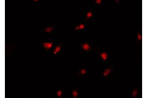 ABIN6269390 staining A-431 cells by IF/ICC. (Aurora Kinase B antibody)