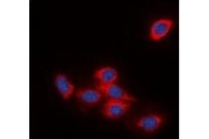 Immunofluorescent analysis of DOK2 staining in HeLa cells. (DOK2 antibody)