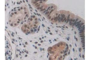 Detection of CSPG4 in Rat Kidney Tissue using Polyclonal Antibody to Chondroitin Sulfate Proteoglycan 4 (CSPG4) (NG2 antibody  (AA 1919-2258))