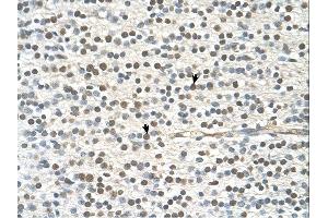 GAPVD1 antibody was used for immunohistochemistry at a concentration of 4-8 ug/ml. (GAPVD1 antibody  (N-Term))