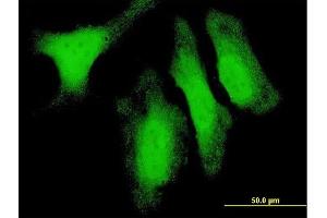 Immunofluorescence of monoclonal antibody to DUSP14 on HeLa cell. (DUSP14 antibody  (AA 1-198))
