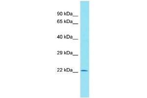 Host: Rabbit Target Name: C11orf40 Sample Type: Hela Whole cell lysates Antibody Dilution: 1. (C11orf40 antibody  (N-Term))