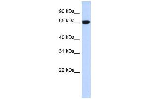 WB Suggested Anti-GTPBP2 Antibody Titration:  0. (GTPBP2 antibody  (N-Term))
