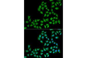 Immunofluorescence analysis of A549 cell using ELF1 antibody. (ELF1 antibody)