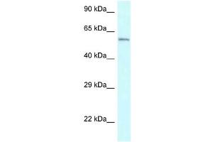 Western Blot showing CYP2U1 antibody used at a concentration of 1 ug/ml against Jurkat Cell Lysate (CYP2U1 antibody  (Middle Region))