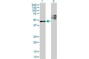 Western Blot analysis of STARD3 expression in transfected 293T cell line by STARD3 monoclonal antibody (M01), clone 1D1. (STARD3 antibody  (AA 1-445))