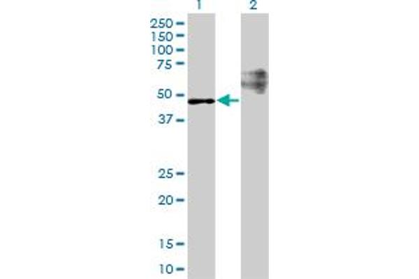 STARD3 anticorps  (AA 1-445)