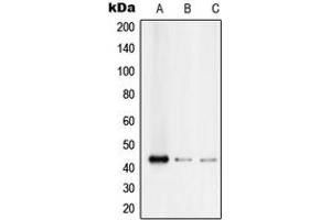 Western blot analysis of RUNX3 expression in Jurkat (A), Raji (B), SW480 (C) whole cell lysates.
