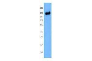 Western Blotting (WB) image for anti-B-Cell CLL/lymphoma 11B (Zinc Finger Protein) (BCL11B) antibody (ABIN2666300) (BCL11B antibody)