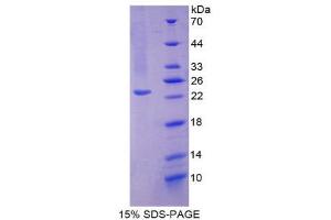 SDS-PAGE (SDS) image for Superoxide Dismutase 2, Mitochondrial (SOD2) (AA 25-222) protein (His tag) (ABIN1080867)