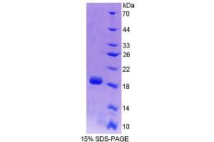 SDS-PAGE (SDS) image for Phospholipid Transfer Protein (PLTP) (AA 337-479) protein (His tag) (ABIN4989496)