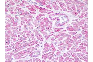 Anti-NDUFV1 antibody IHC staining of human heart. (NDUFV1 antibody  (AA 21-50))