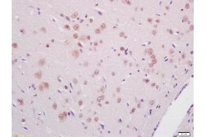 Formalin-fixed and paraffin embedded rat brain tissue labeled with Anti-PKR (Thr446) Polyclonal Antibody, Unconjugated(ABIN744788) 1:200 followed by conjugation to the secondary antibody and DAB staining (EIF2AK2 antibody  (pThr446))