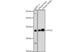 Western blot analysis of extracts of various cell lines, using PHD3 antibody (ABIN6130355, ABIN6139990, ABIN6139991 and ABIN6224021) at 1:1000 dilution.