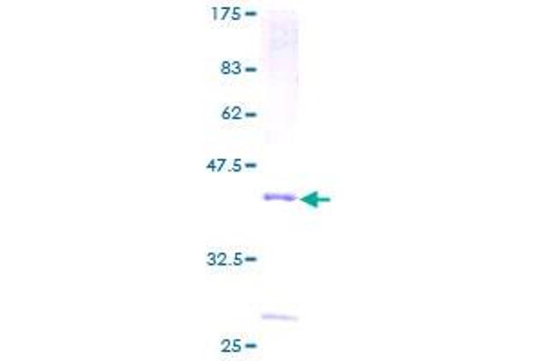PLA2G2D Protein (AA 1-145) (GST tag)