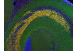 Indirect immunostaining of a PFA fixed mouse hippocampus section with anti-synapsin 3 (dilution1 : 500; red) and guinea pig anti-synapsin 1,2 (cat. (Synapsin III antibody  (AA 417-434))