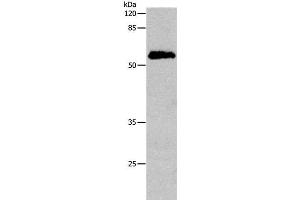 Western Blot analysis of Human cervical cancer tissue using CDC20 Polyclonal Antibody at dilution of 1:600 (CDC20 antibody)