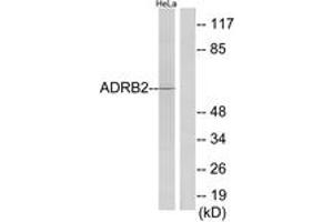 Western Blotting (WB) image for anti-Adrenergic, beta-2-, Receptor, Surface (ADRB2) (AA 201-250) antibody (ABIN2889857) (beta 2 Adrenergic Receptor antibody  (AA 201-250))
