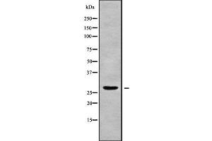 Western blot analysis of C1QL3 using Jurkat whole cell lysates (C1QL3 antibody  (Internal Region))