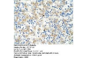 Rabbit Anti-EXOSC6 Antibody  Paraffin Embedded Tissue: Human Liver Cellular Data: Hepatocytes Antibody Concentration: 4. (EXOSC6 antibody  (N-Term))