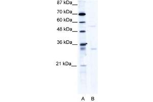 Western Blot showing TRIM17 antibody used at a concentration of 1-2 ug/ml to detect its target protein. (TRIM17 / RNF16 antibody  (C-Term))