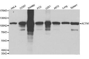 Western blot analysis of extracts of various cell lines using ACTN1 antibody. (ACTN1 antibody  (AA 1-330))