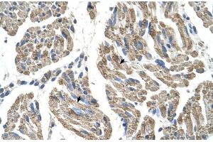 Human Muscle (SLC25A38 antibody  (Middle Region))